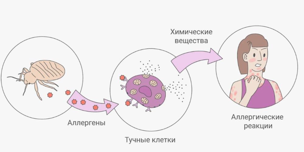 Что такое аллергия?