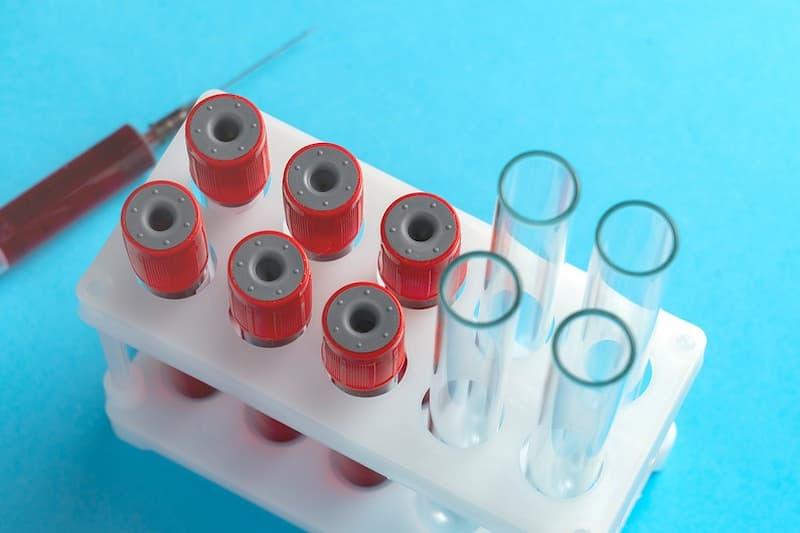 О диагностике ВИЧ-инфекции и профилактике